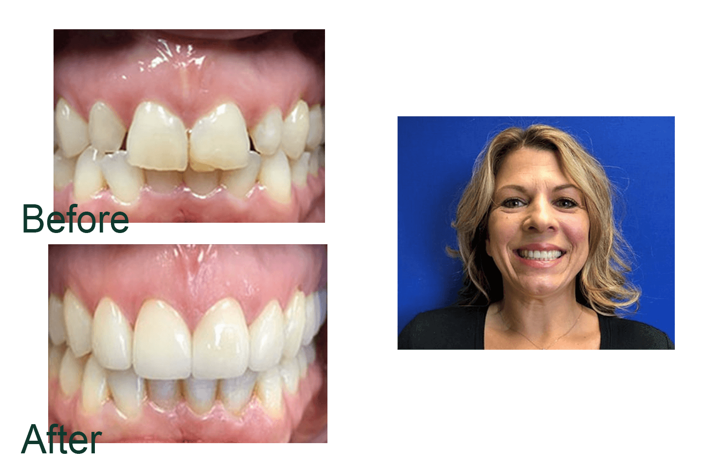 Before and after image