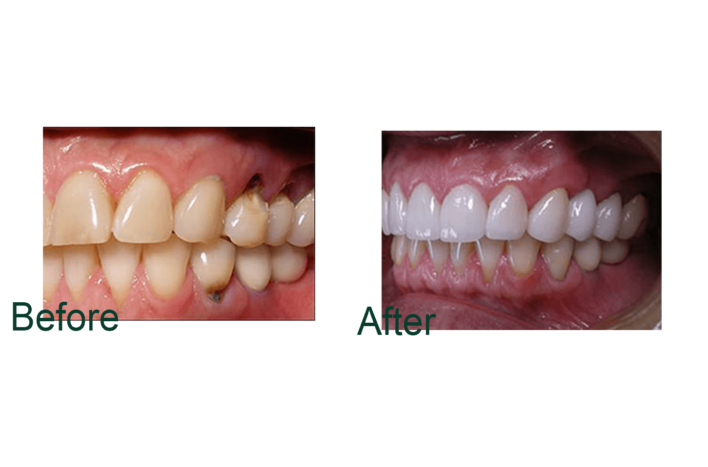 Before and after image