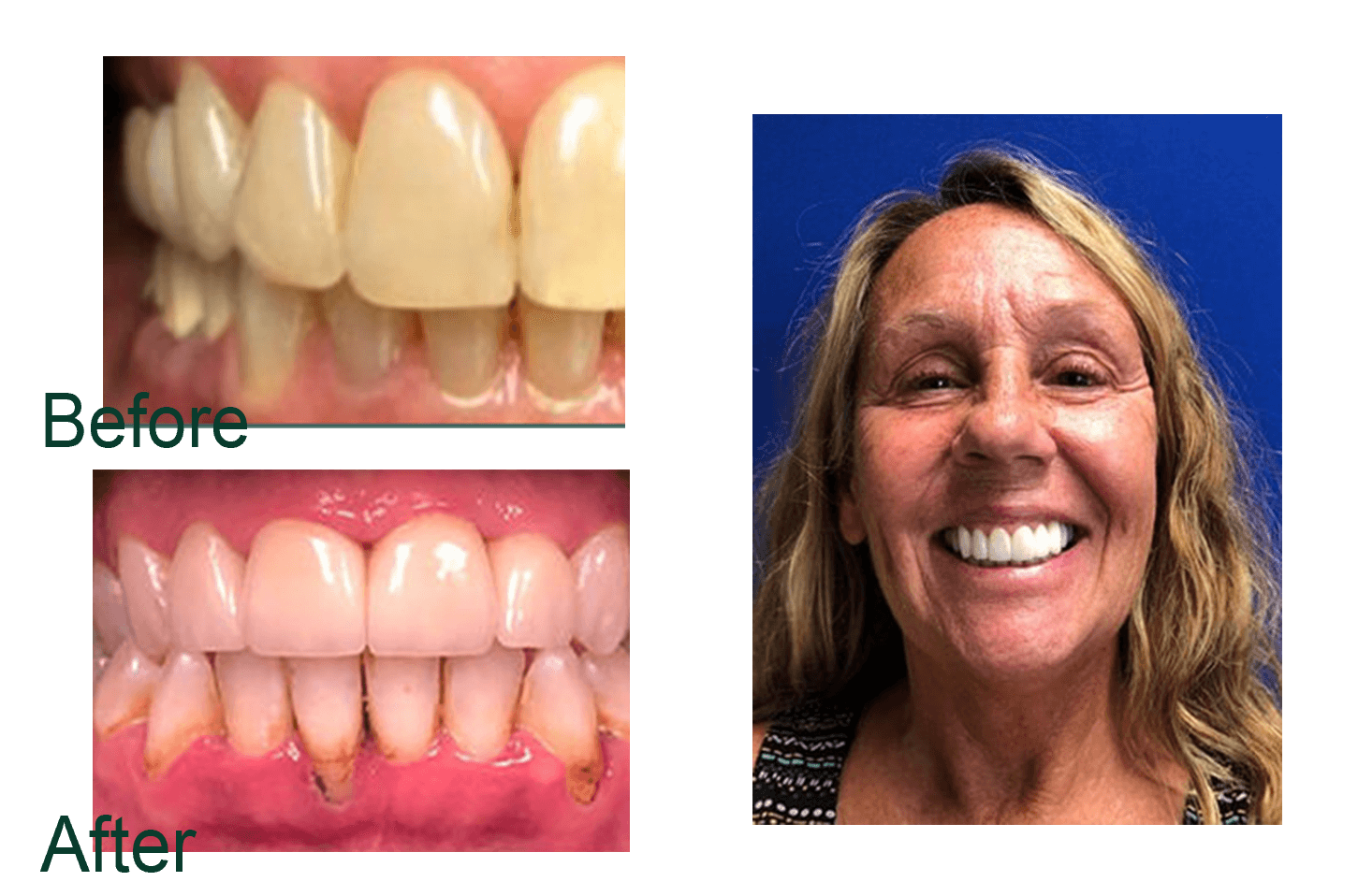Before and after image