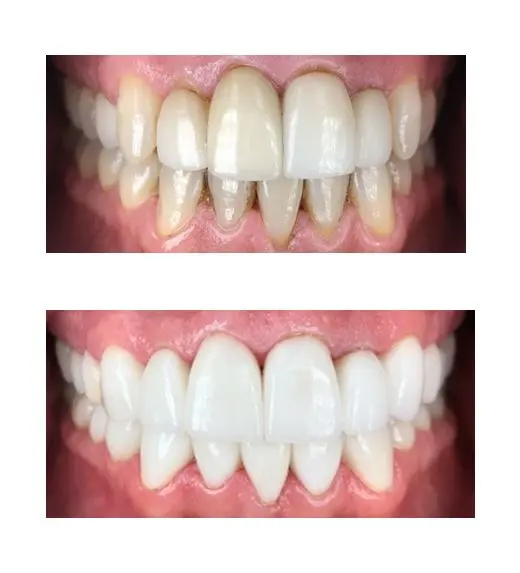 Before and after image