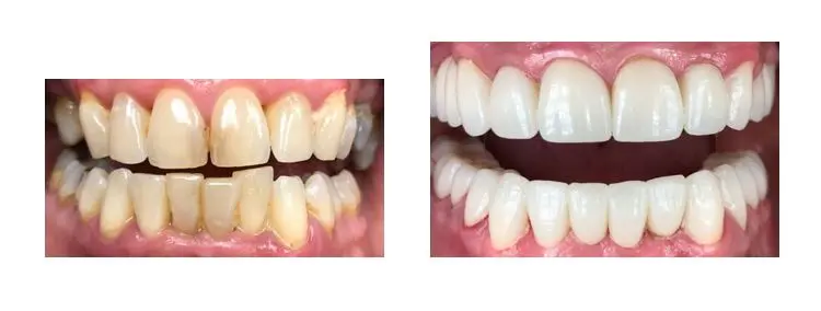 Before and after image
