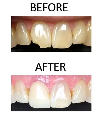 Before and after image