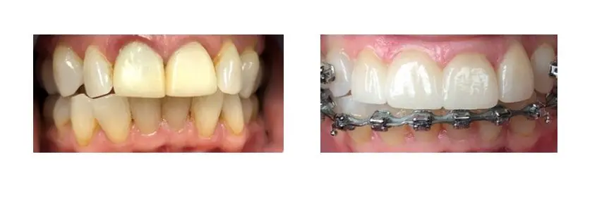Before and after image