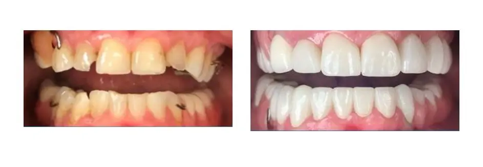 Before and after image