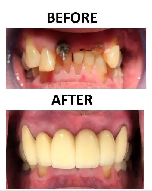 Before and after image
