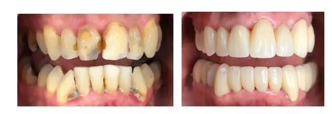 Before and after image