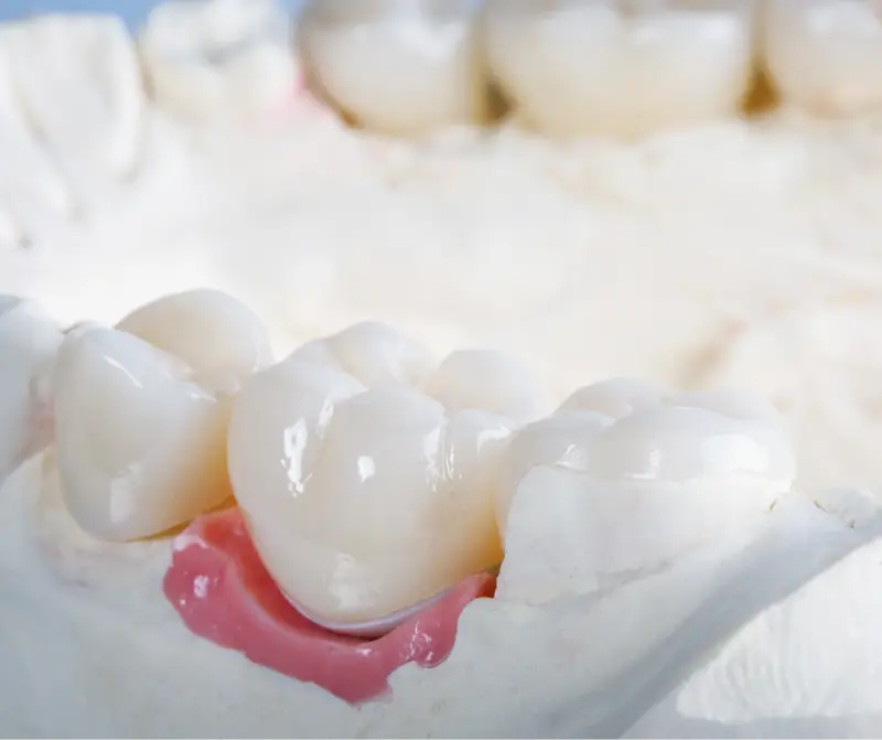 crowns up close teeth crowns up close teeth